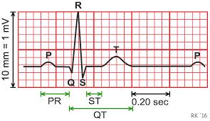 12-kytkentäinen lepo-ekg Ei hyötyä rutiininomaisesta EKG:stä, jos oireeton potilas menee matalan riskin toimenpiteeseen.