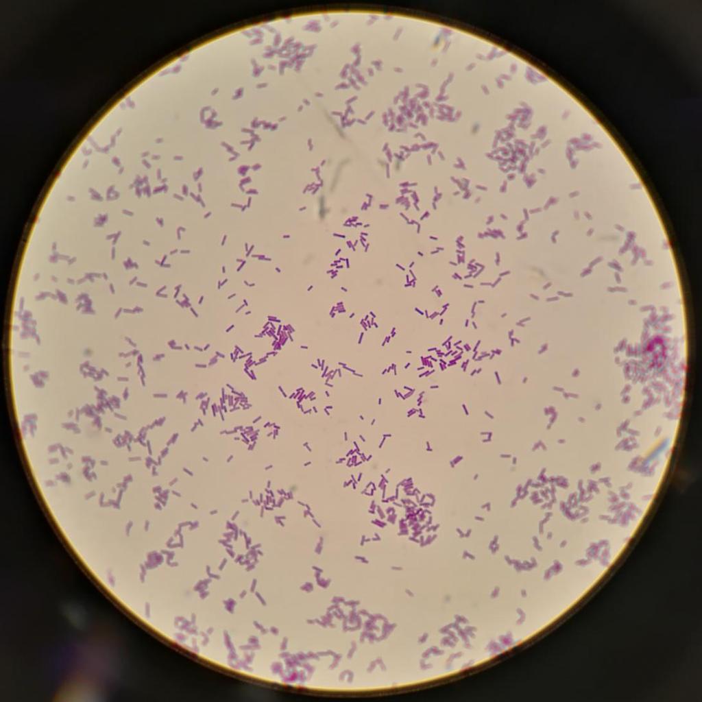 3 Kuva 1. Mikroskooppikuva gram-värjätyistä Clostridium perfringens -bakteereista C. perfringens on ehdoton anaerobi, eli se ei kykene käyttämään happea soluhengityksessään.