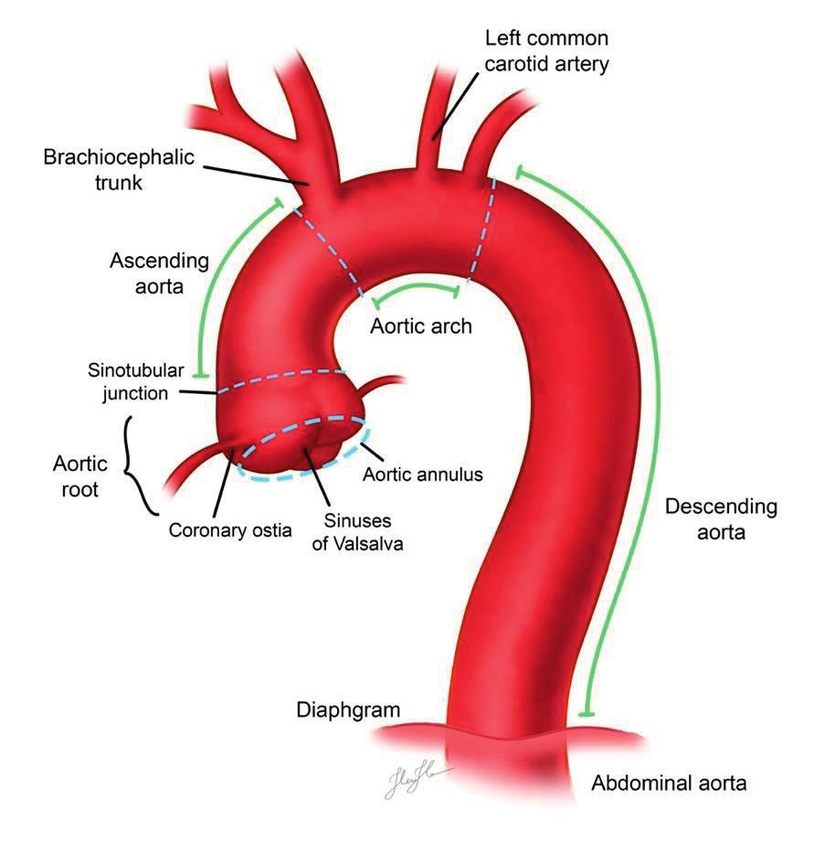 Stanford and DeBakey classifications of aortic