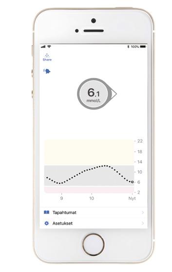 DEXCOM G6: NÄIN SE