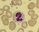 5.2 Hematologian laboratorio Hematologian laboratoriossa tutkitaan perusverenkuvaa, hematologisia sairauksia sekä suoritetaan punktionesteiden solulaskentaa.