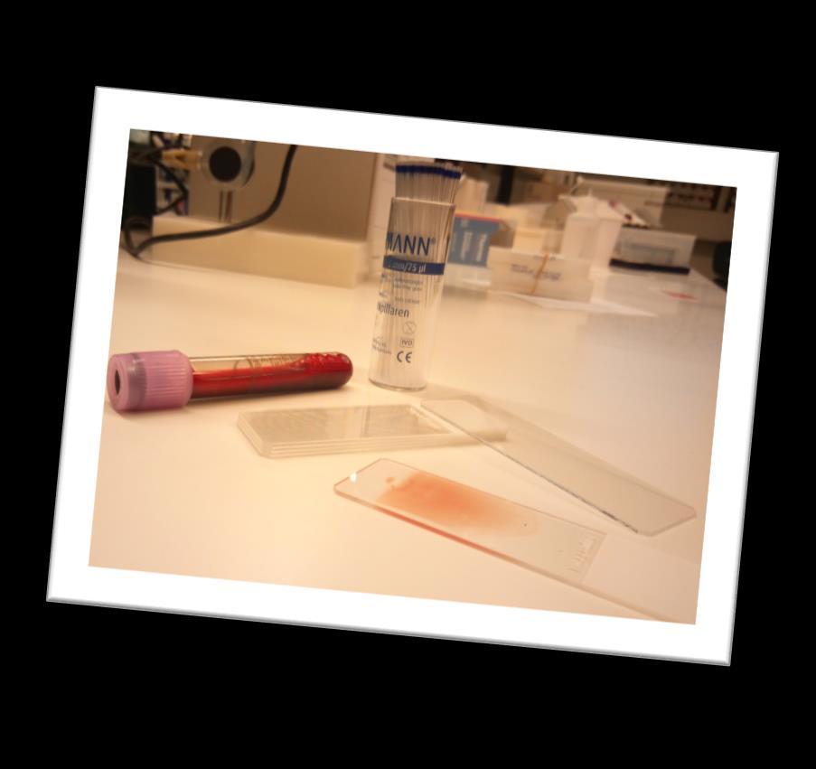 4.5 Hematologia Hematologian laboratoriossa tehdään valkosolujen erittelylaskentaa mikroskoopilla.