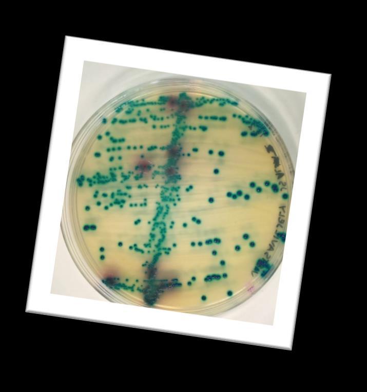 4.7 Mikrobiologia Mikrobiologian laboratoriossa tehdään bakteriologisia, mykologisia ja parasitologisia tutkimuksia, esimerkiksi veriviljelyitä, ulostetutkimuksia ja syvämärkäviljelyitä.