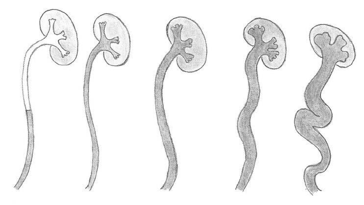 I II III IV V Figure 1.