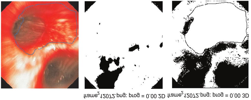 Ramka z zaznaczonym obszarem krew (a), fragment histogramu 2D ca³ego obrazu (b), fragment histogramu 2D obszaru zaznaczonego (c).