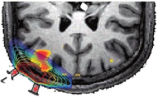 Review of literature 17 Figure 2: Schematic diagram of the principle of near-infrared spectroscopy. Diagram created by Dr. Theodore Huppert; displayed by the permission of the creator. 2.2.2 Emotion processing models In the 2000s, two models of emotion processing emerged.