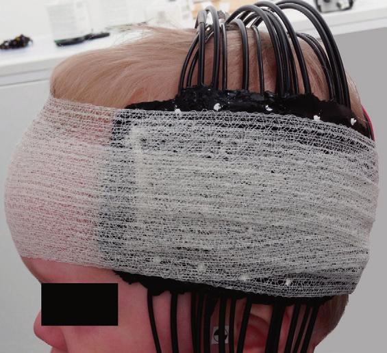 Materials and methods 33 Figure 3. The fiber-optic measurement probe was wrapped around the child s head with self-adhesive bandage.