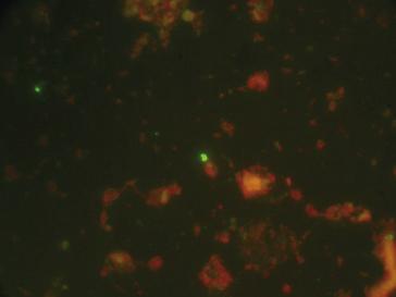 62 Diagnostics Fig. 15 Cells of Clavibacter michiganensis subsp michiganensis (technique used: IF). Fig. 16 Dividing cells of Clavibacter michiganensis subsp michiganensis with a typical V-shape (technique used: IF).
