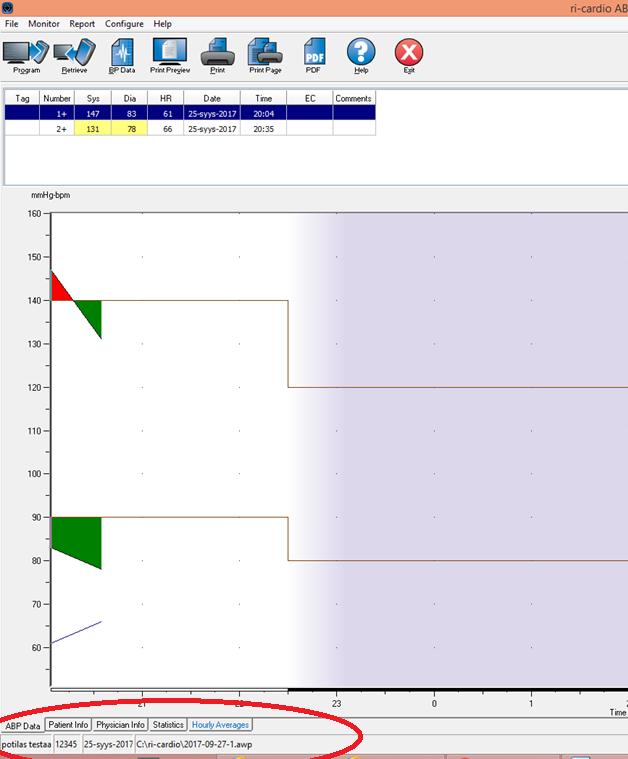 Potilaan ja rekisteröinnin tiedot ovat nyt tallennettuna tietokoneellesi. ABP Data-ikkuna näyttää siirretyt tiedot.