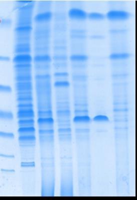 25 the OPOE insoluble membranes. In these conditions, FhuA is recovered in the supernatant Figure 12. 10 % SDS-PAGE (200 V).