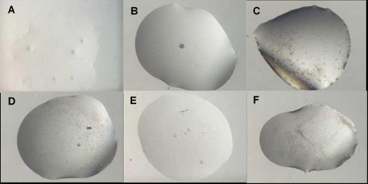 Figure 17. A: Few round crystals of FhuA-pb5-VHH64 complex (6.9 mg/ml) B: FhuA-pb5-VHH53 (6.7 mg/ml) forming a single crystal.