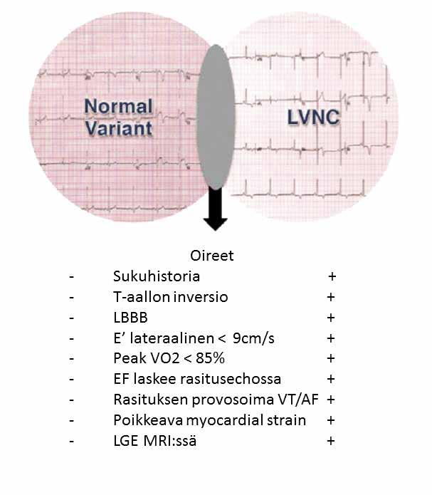 Oikean kammion trabekulaatiolle ei ole magneettikuvauksen diagnostisia kriteereitä.