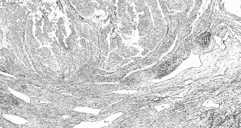 Review of literature mouse model findings and preclinical studies into the clinic are needed.