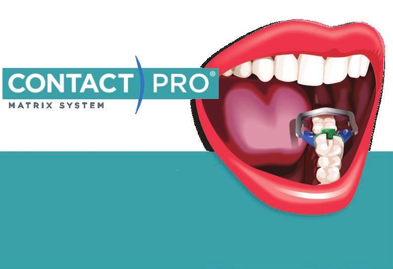 UUTUUS! Bluephase G4 Tyylikäs, älykäs ja luotettava! Luotettavaa laatua ContactPro Matrix System Helppo käyttää luokan II restauraatioihin.