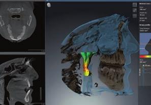 3D Endo on yksinkertainen ja johdonmukainen