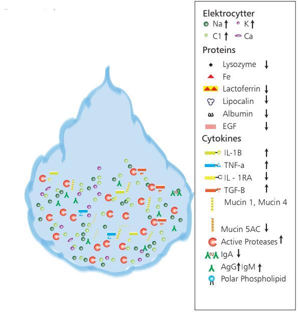 12 Kuvio 5. Kyynelnesteen rakenteen epätasapainoisuus vaikuttaa kuivasilmäisyyteen. Kyynelnesteen muodostavia komponentteja voi olla liikaa tai liian vähän. (Courtesy of Heegaard ym. 2015: 11.