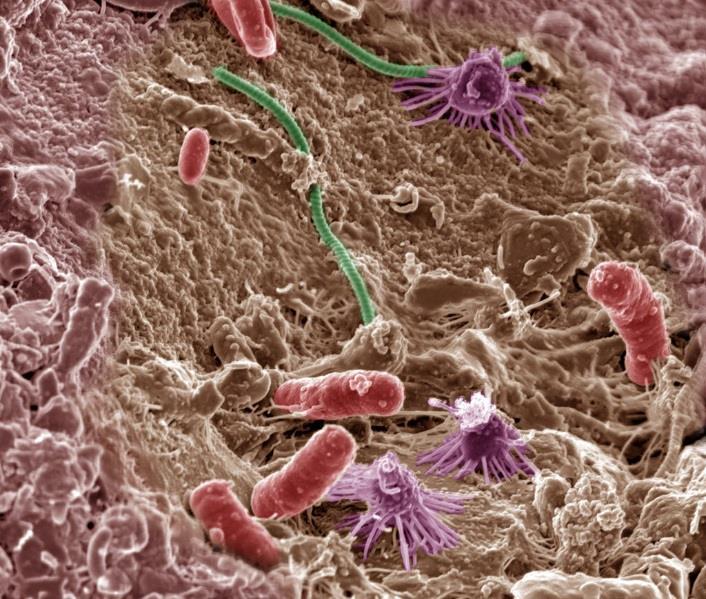 Taustaa - Mikrobit Mikro-organismit: Bakteerit, arkit, mikroskooppiset organismit (mm.