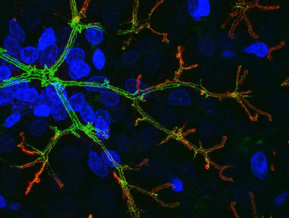 26 Hiirillä ja rotilla tehdyissä immunohistologisissa tutkimuksissa selvitettiin AQP5 sijoittumista sylkirauhasoluissa.