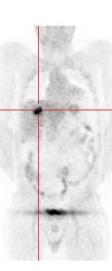 +++++ 0,3 mm +