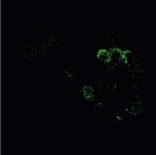 51 and the extrasynaptic type GluN2B in trigeminal ganglia cultures. Our immunocytochemistry data showed that the GluN2A receptor subunit was expressed in trigeminal neurons and SGCs (Fig.