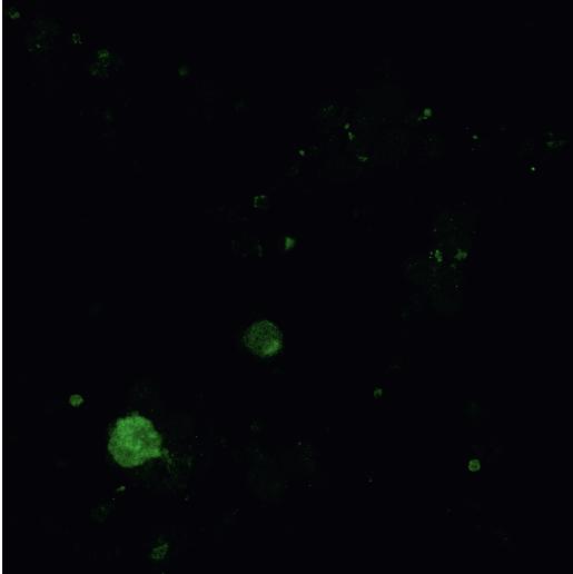 Expression of GluN2A and GluN2B receptor subunits in trigeminal ganglia cells A. GluN2A immunostaining. B. GluN2B immunostaining.