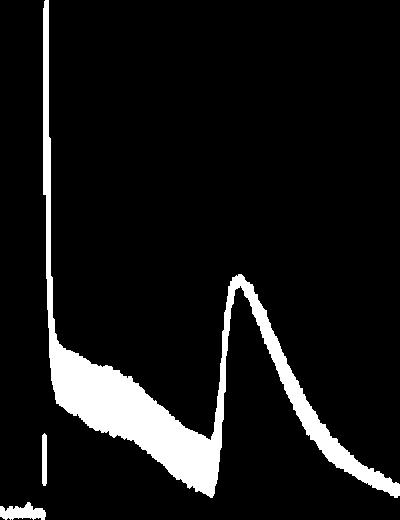 Representative ΔF/F0 Ca2+ -traces from trigeminal neurons (n=5, average) showing Ca2+ -transients evoked by adenosine triphosphate (ATP, 1