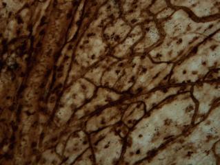 adenosine nucleotide (all 200 µm): ATP, ADP, or AMP. Control was treated in the absence of nucleotide.