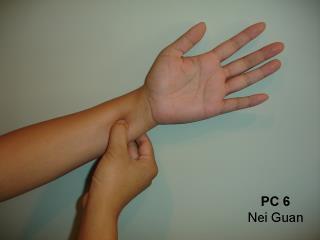 Ensimmäisessä kuvassa määritellään oikea anatominen paikka potilaan omien sormien avulla. Toisessa kuvassa näytetään tekniikka miten pistettä painetaan. KUVA 1.