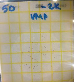 42 T59 1 3-2 T60 2 4-2 KO58 <1 5-5 KO59 1 3-2 KO60 7 6 1 KO61 5 10-5 KO62 4 3 1 36 VMP 7 >250 50 VMP 3 72-69 K29 VMP 1 4-3 K42 VMP 4 2 2 T4 VMP 7 17-10 T12 VMP 1 7-6 KO50 VMP <1 4-4 KO51 VMP 1 6-5
