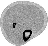 54 FIGURE 18 Tangential positioning of the array probe for both radius and tibia, superimposed with pqct images of the measurement location.