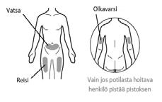 Valmistautuminen: Anna injektiopullon/injektiopullojen lämmetä ennen käyttöä huoneenlämpöiseksi noin 15 minuutin ajan puhtaalla, tasaisella alustalla poissa suorasta auringonvalosta.