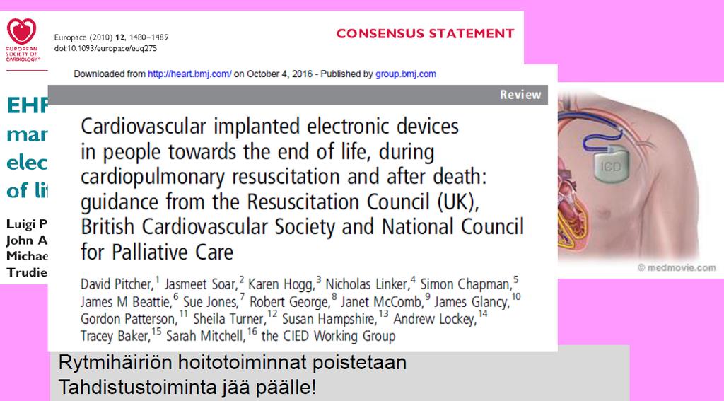 RYTMIHÄIRIÖTAHDISTIN (ICD) JA