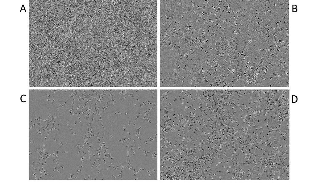 Figure 1. Images acquired by IncuCyte ZOOM of a cell culture well containing HUVECs in the different numbers of cells.