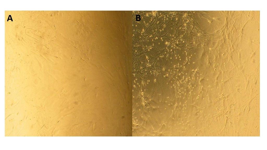 in the group of MSCs when comparing only collagen to 1:1 Matrigel:collagen gel ratio (Wilcoxon signed-rank test; p<0.05). Figure 5.