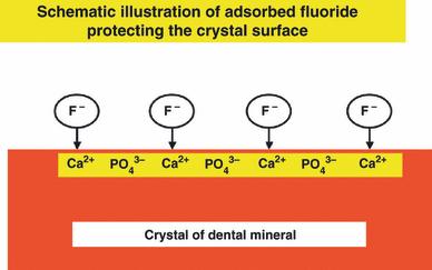 20 jatkuvasti, eikä syljen puskurointikyky ole riittävää, altistuu hammas kariekselle. Fluoridilla voidaan vaikuttaa tähän kiilteen kemialliseen liukenemisprosessiin.