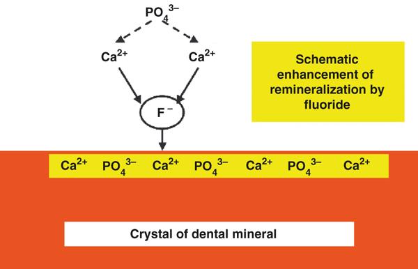21 Kuva 3. Kiilteeseen sitoutunut fluoridi sitoo kalsiumia, joka puolestaan sitoo fosfaattia. Hampaan pintaan muodostuu fluoroapatiittikerros (Featherstone 2008).