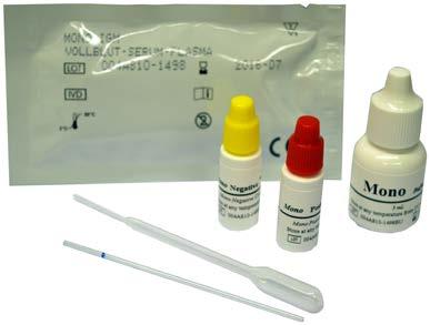 Ultimed Monotest Immunokromatografinen kasettitesti heterofiilisten mononukleoosivasta-aineiden osoittamiseen verinäytteestä.