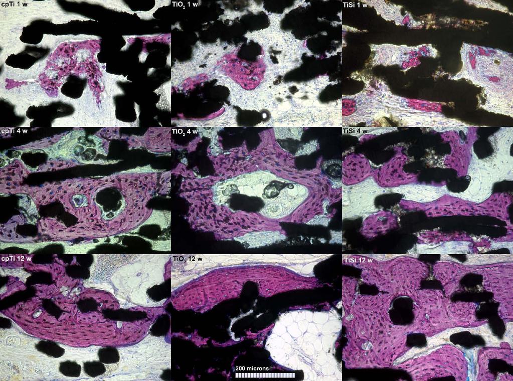 Results 5.2.4 Ectopic bone formation (II) After one week multiple patches of unorganized mineralizing tissue with scarce amounts of woven bone were seen in all implants.