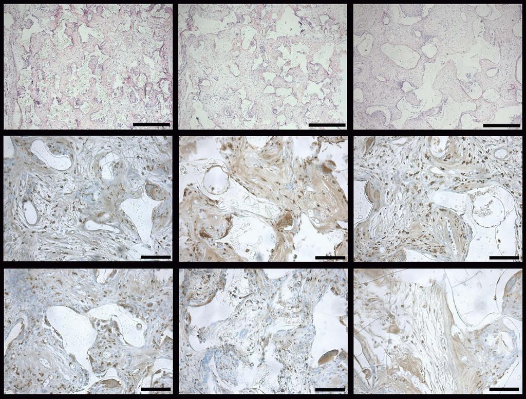 Results 5.3.5 Cell free implantations (V) Similar tissue reactions were observed for all cell free scaffold types after four weeks of implantation, irrespective of the polymer matrix or BAG filler.
