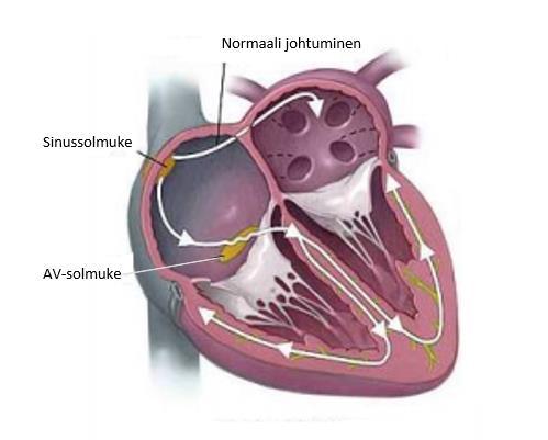 Sydämen rytminen toiminta perustuu sähköilmiöön.