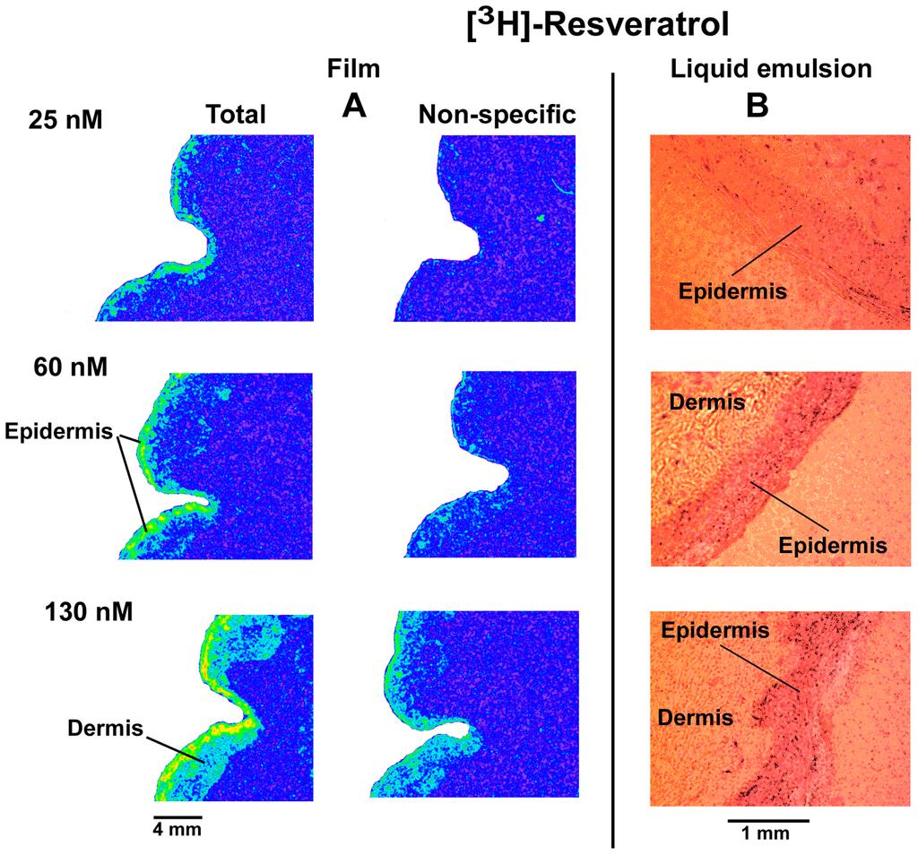 23 Figure 17A shows that most of [3 H]-resveratrol was found in epidermis, where intensity of the signal is dependable of [3 H]-resveratrol concentration.