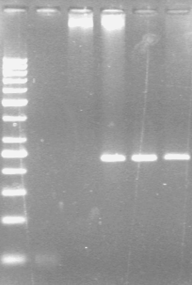 Supplementary Figure 1. fgr sequence used for real-time PCR. Amplicon obtained from blue forward primer gives a 236 bp amplicon and red forward primer amplifies an 80 bp band.