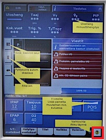 4.4 Graafinen näyttö Philips Respironics V60- hengityslaitteessa on 12,1 tuuman kosketusnäyttö. Näytön yläosassa sijaitsee hälytysrivi (kuva 4).