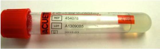 fs-ca-ion, S-Immunoglobuliinit A, G, M, S-Prot, S-Prealb, S-HAVAbG, S-HAVAbM, S- HBcAb S-HBcAb, MS-HBsAg, S-HBsAb, S-HCVAb, S-HIVAgAb.