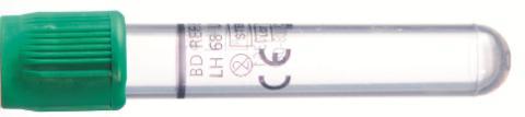 P-AFOS, P-ALAT, P-Alb, P-Amyl, P-ASAT, P-Bil, P-Bil-Kj (jos pyydetty P-Bil tai P-Bil-Kj laita putki tummaan suojusputkeen), P-B12-Vit, fp-ca, P- CA12-5, P-CEA, P-CK,