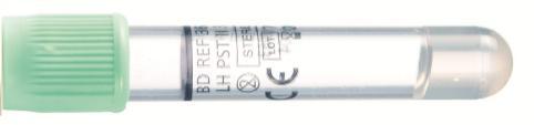 fp-pi, P-ProBNP, P-PRL, P-PSA, P-PTH, P-Rf, P-SHBG, fp-tfr, P-TnT, P-Transf, fp- Trigly, P-TSH, P-T3V, P-T4V, P-Uraat, fp-urea Tutkimus fp-gluk/ P-Gluk käytetään