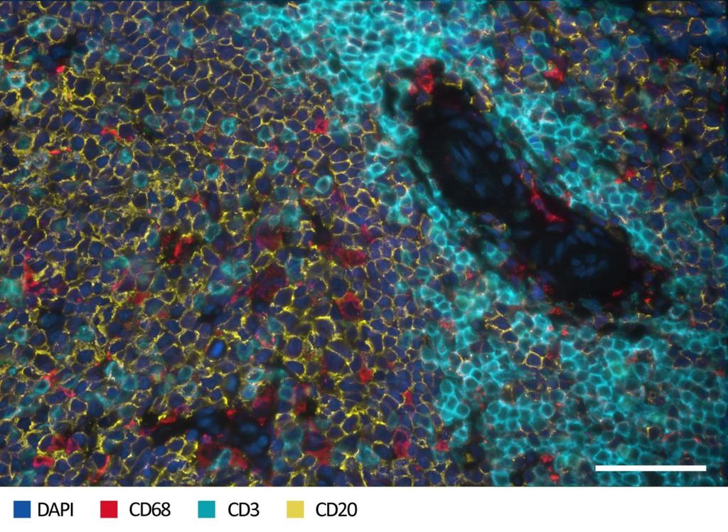 Figure 7. The human spleen stained with B cell, T cell, and macrophage markers.