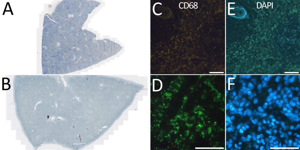 Figure 8. Comparison of counterstaining spleen tissue samples using hematoxylin and Sudan black.