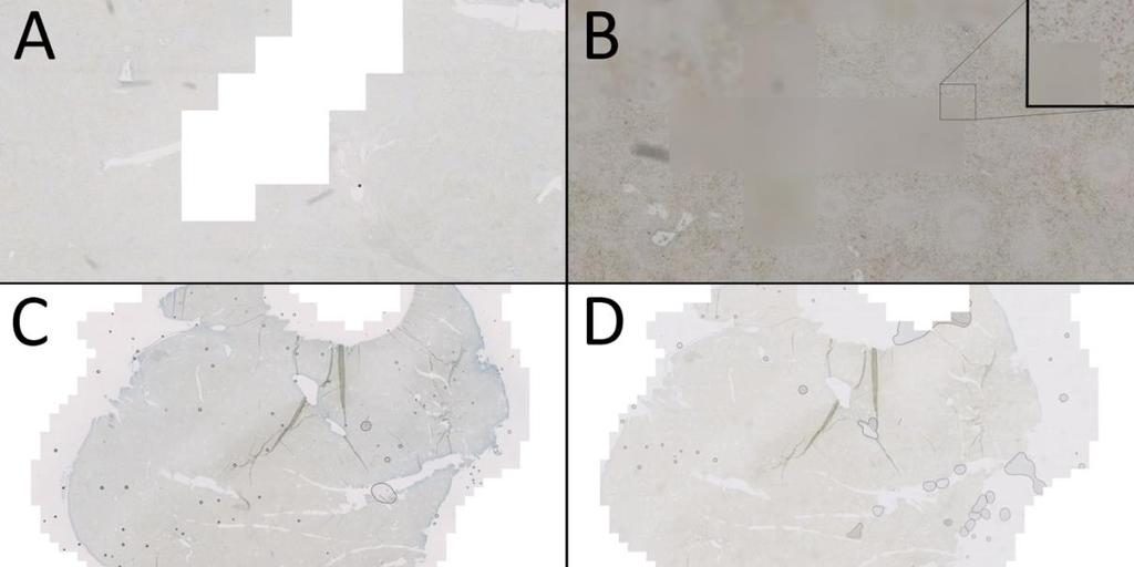 to technical reasons found in the scanner. Due to many technical challenges, the npod samples were only scanned after the initial VP1 staining.