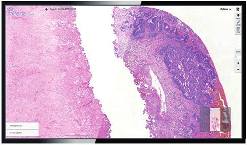Patologia» Tekniikka 654 Histologiset värjäykset Aiheet 202:. kierros (huhtikuu): ELASTIN, GRAM 2.